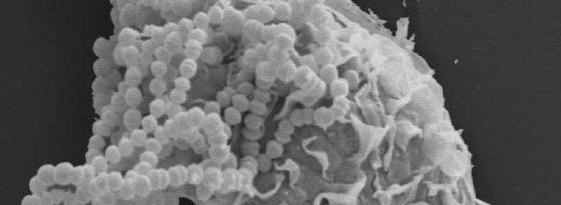  Scanning electron microscope image of cell with bacteria